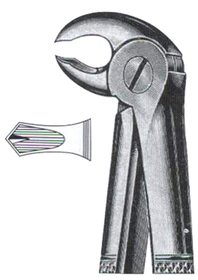 Lower Molars Hawks Bill